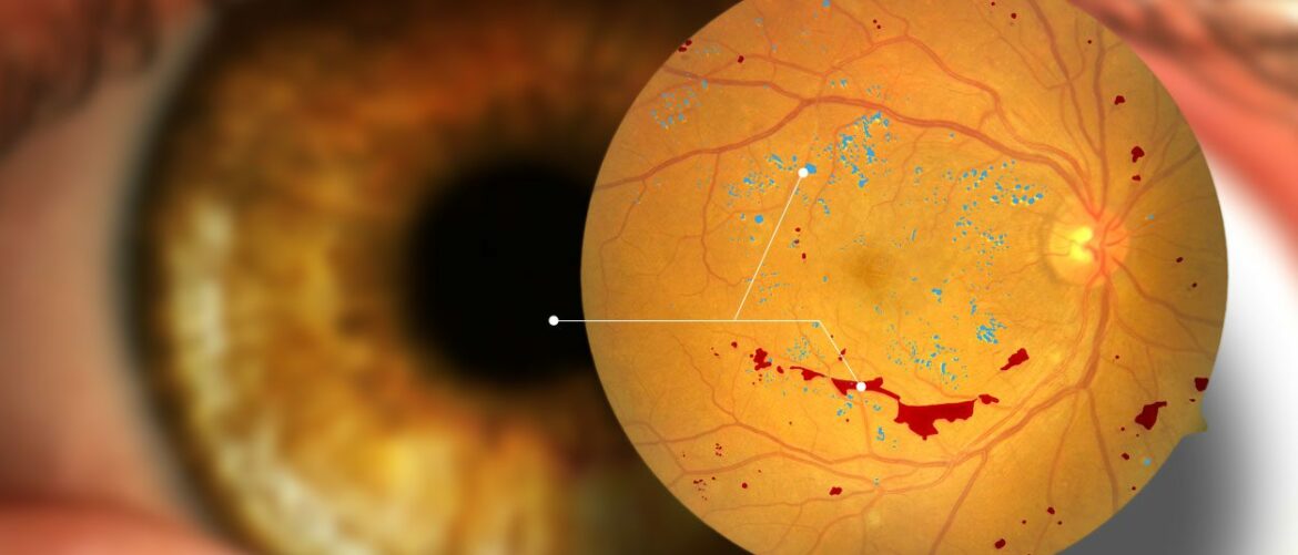 Diagnos reçoit 2M$ de la part de Québéc