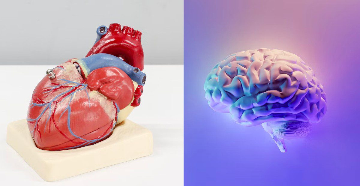 L’IA pour prévenir les risques d’AVC